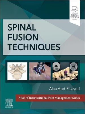 cover image of Spinal Fusion Techniques--E-Book